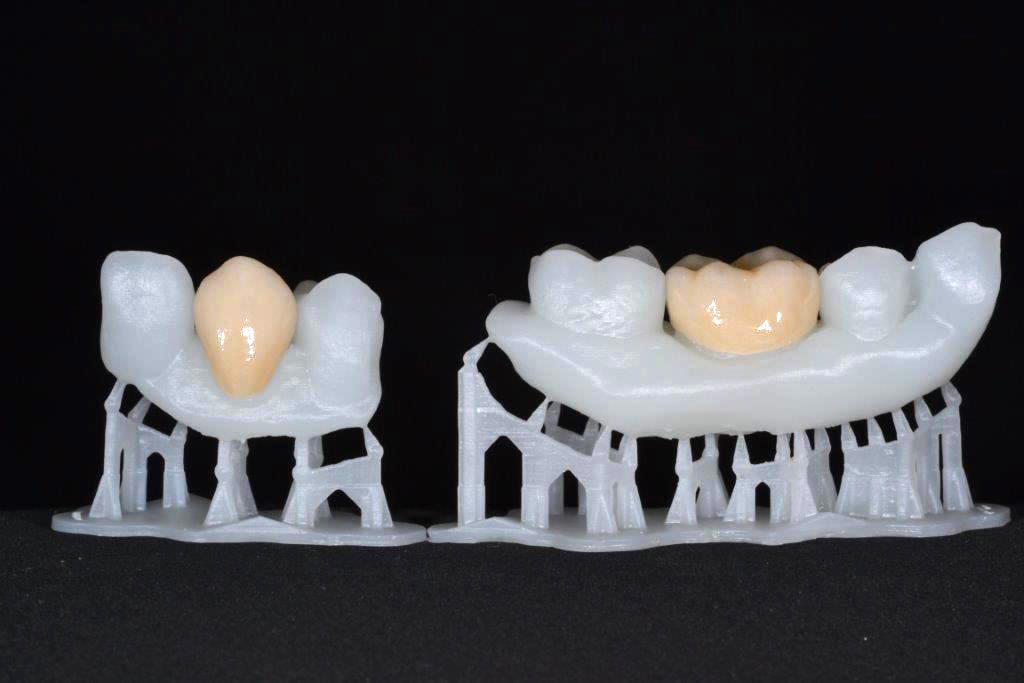 Snap Dental Studio: hasta anlatımı ve cerrahi planlama için basılı referans modeller