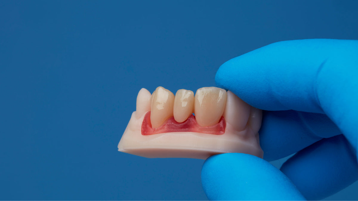 Yeni Model Resin formülü: restoratif modellerde daha kısa baskı ve son işlem