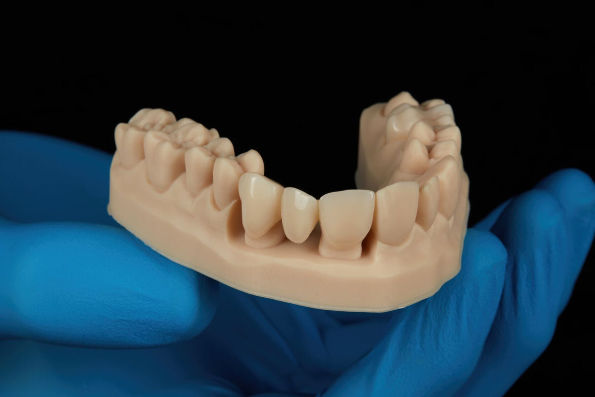 3D Baskı Daimi Kron ve Köprüler