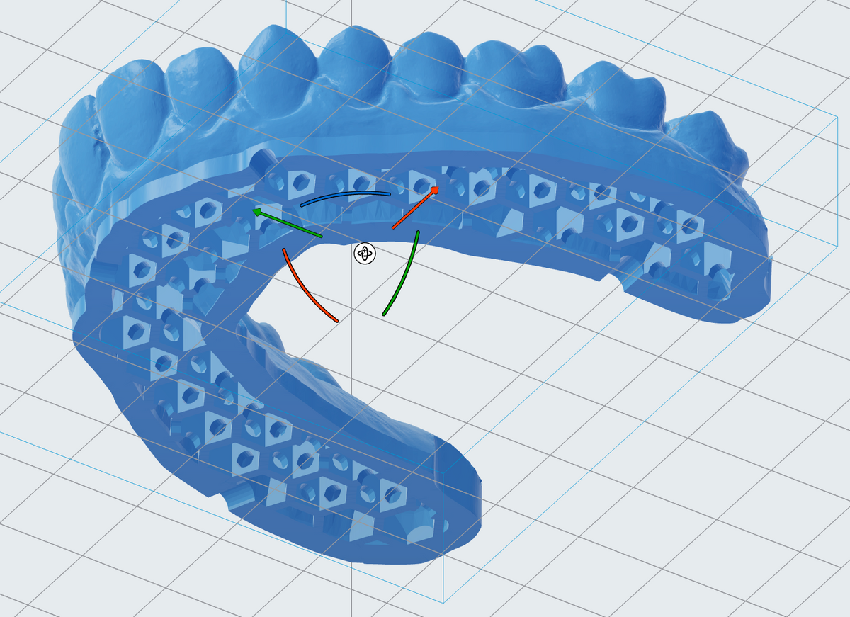 PreForm Dental 3.41.0: otomatik kesme düzlemi, içi boş model, etiket ve Print Settings Editor