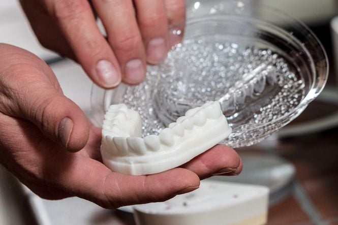 Mum Frezesi Yerine Baskı: CMR Dental Lab'de Diagnostik Wax-Up